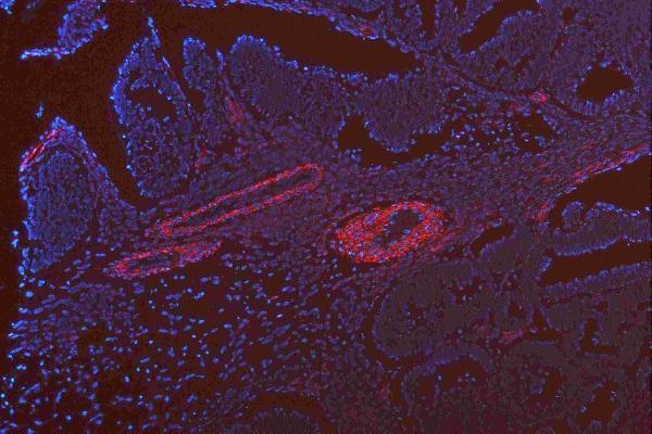 Alpha-Smooth Muscle Actin antibody analysis