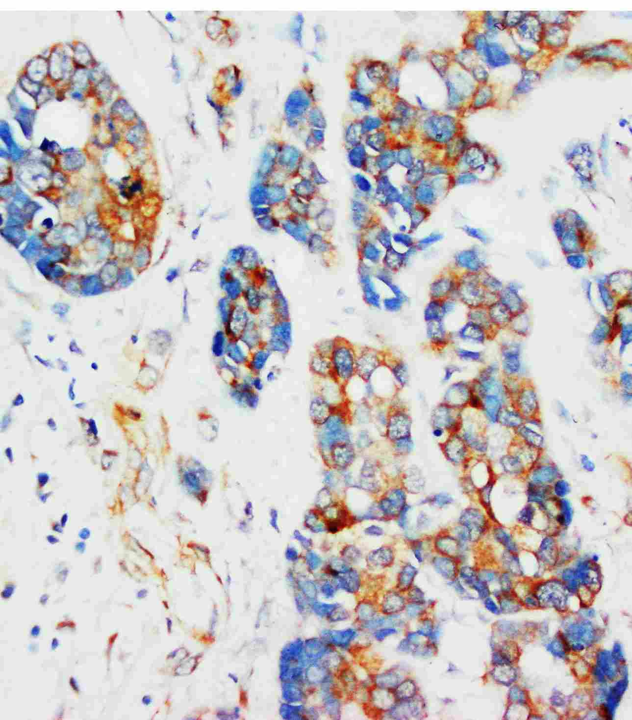 Anti-Alpha-Tubulin TUBA1A Antibody (Monoclonal, 31T07)