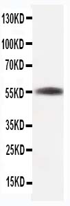 Anti-Beta-Tubulin TUBB1 Antibody (Monoclonal, 35T48)