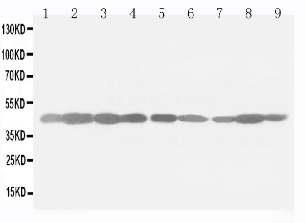 Anti-Beta-Actin Actb Antibody (Monoclonal, 31A06)