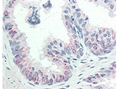 Immunohistochemistry of Mouse anti-AKT pS473 antibody