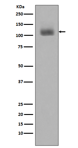 Western blot analysis of JAK2 phosphorylation expression in Jurkat cell lysates treated with Pervanadate