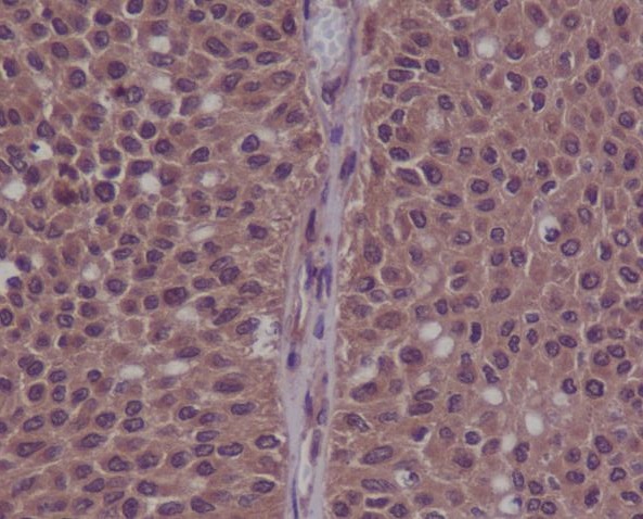 mp00166 ihc