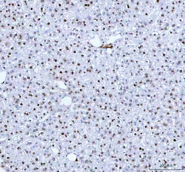 Figure 5. IHC analysis of HistoneH2A.X using anti-HistoneH2A.X antibody (MP00241). HistoneH2A.X was detected in a paraffin-embedded section of mouse liver tissue. Heat mediated antigen retrieval was performed in EDTA buffer (pH 8.0, epitope retrieval solution). The tissue section was blocked with 10% goat serum. The tissue section was then incubated with 1:50 rabbit anti-HistoneH2A.X Antibody (MP00241) overnight at 4°C. Peroxidase Conjugated Goat Anti-rabbit IgG was used as secondary antibody and incubated for 30 minutes at 37°C. The tissue section was developed using HRP Conjugated Rabbit IgG Super Vision Assay Kit (Catalog # SV0002) with DAB as the chromogen. Figure 5. IHC analysis of HistoneH2A.X using anti-HistoneH2A.X antibody (MP00241). HistoneH2A.X was detected in a paraffin-embedded section of mouse liver tissue. Heat mediated antigen retrieval was performed in EDTA buffer (pH 8.0, epitope retrieval solution). The tissue section was blocked with 10% goat serum. The tissue section was then incubated with 1:50 rabbit anti-HistoneH2A.X Antibody (MP00241) overnight at 4°C. Peroxidase Conjugated Goat Anti-rabbit IgG was used as secondary antibody and incubated for 30 minutes at 37°C. The tissue section was developed using HRP Conjugated Rabbit IgG Super Vision Assay Kit (Catalog # SV0002) with DAB as the chromogen.