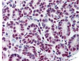 mp01087 stat5a primary antibodies ihc testing 1