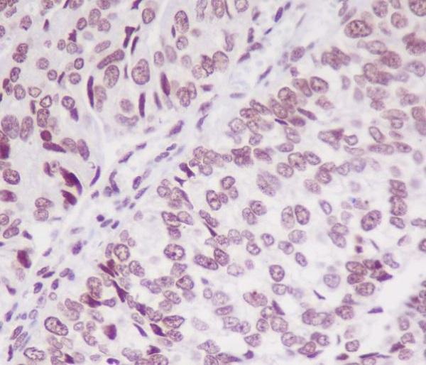 mp02148 ihc