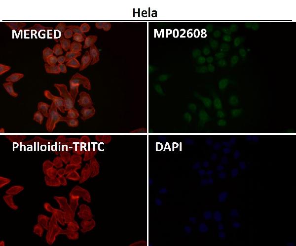 Immunofluorescent analysis of NIH/3T3 cells treated with Anisomycin, using Phospho-JNK1/2/3 (T183+T183+T221) Antibody.