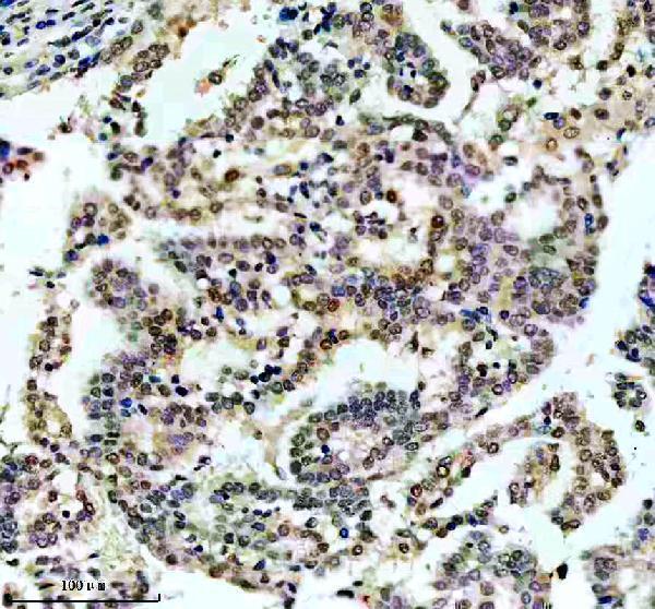 mp02608 p jnk1 2 3 primary antibodies ihc testing 2_1