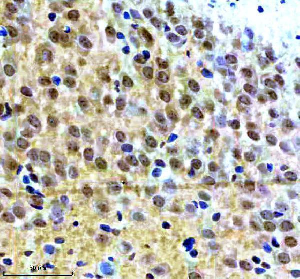mp02608 p jnk1 2 3 primary antibodies ihc testing 3_1