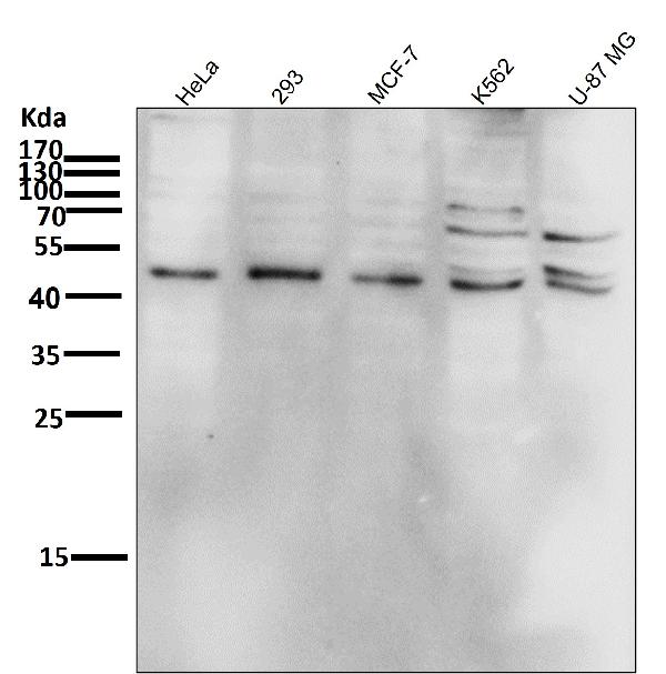All lanes use the Antibody at 1:1K dilution for 1 hour at room temperature.