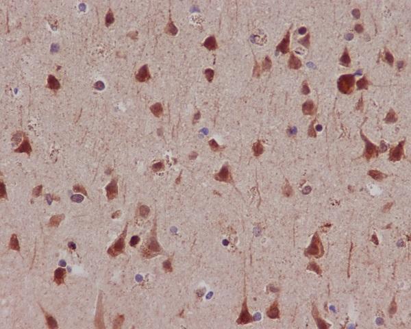 mp04922 ihc