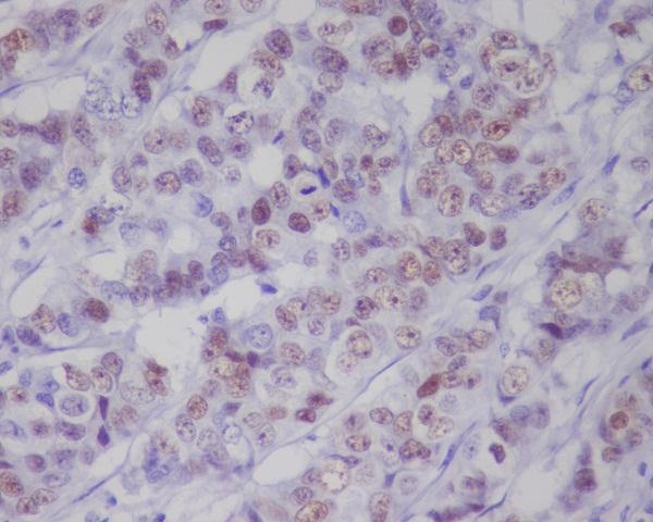p00001 6 ihc