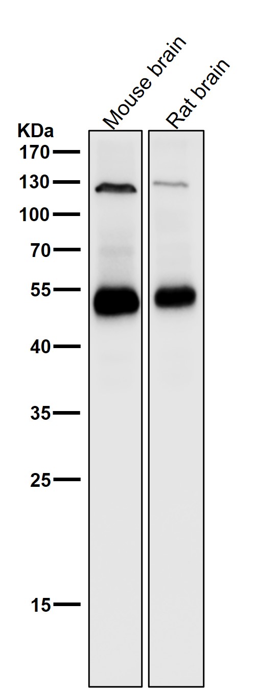 All lanes use the Antibody at 1:1K dilution for 1 hour at room temperature