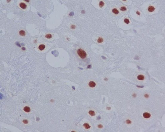 p00007 1 ihc