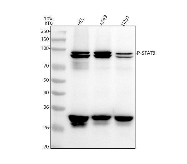  Western blot analysis of STAT3 using anti-STAT3 antibody (P00007-1)