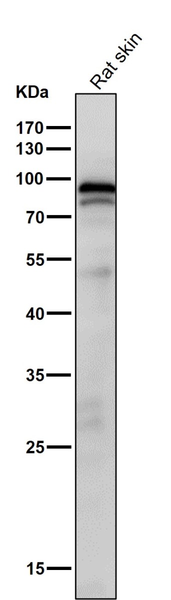 All lanes use the Antibody at 1:1K dilution for 1 hour at room temperature