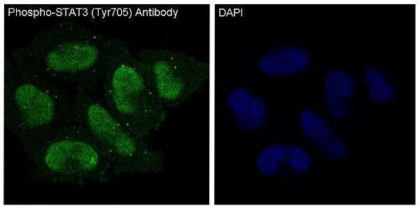 Fluorescence image of Ankylosing Spondylitis antibody