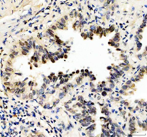 IHC analysis of STAT3 using anti-STAT3 antibody (P00007-2)