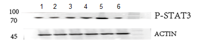  Western blot analysis of Phospho-STAT3 (Y705) using anti-Phospho-STAT3 (Y705) antibody (P00007-2)