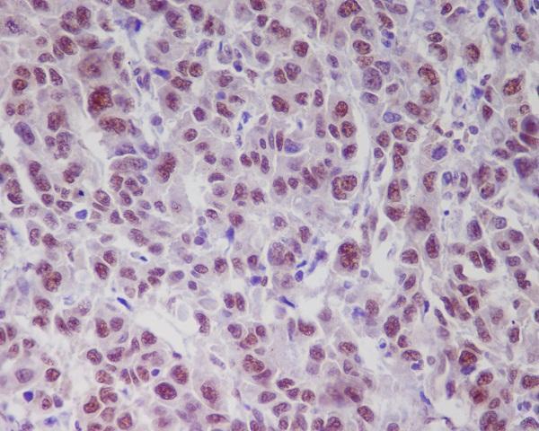 p00014 1 ihc