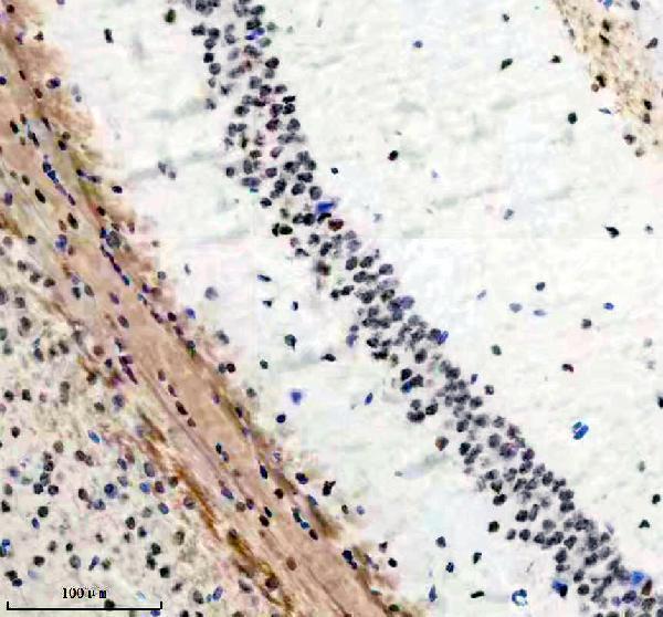 p00018 1 p sirt1 primary antibodies ihc testing 1