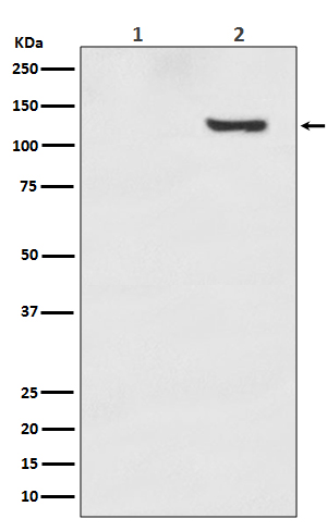 Western blot analysis of Phospho-SIRT1 (T530) expression in (1) 293T cell lysate; (2) 293T cell treated with Calyculin A