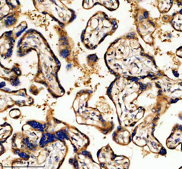 IHC analysis of EGFR using anti-EGFR antibody (P00023-2)