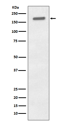 Western blot analysis of Phospho-EGFR (Y1197) expression in A431 cell lysate treated with EGF