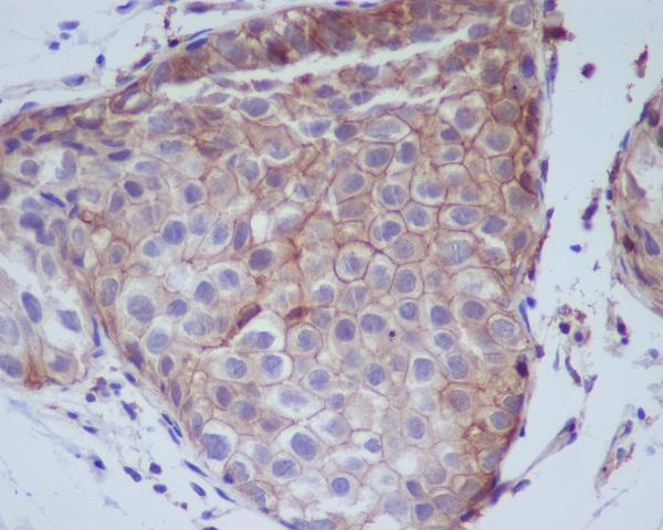 p00023 ihc