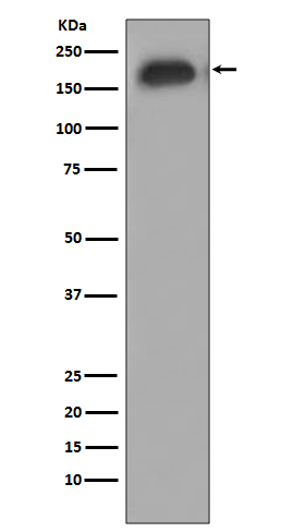 p00023 wb