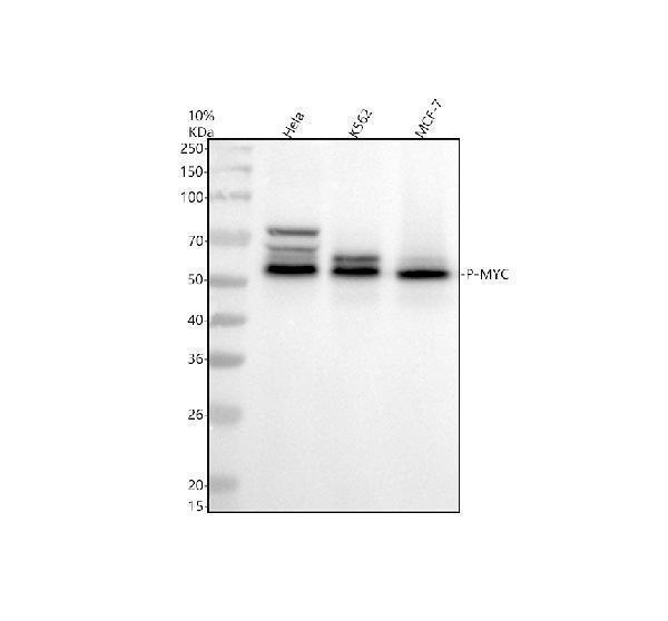 Western blot analysis of P-MYC using anti-P-MYC antibody (P00026-2)