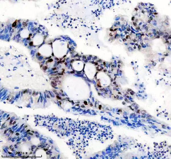 IHC analysis of P-Myc using anti-P-Myc antibody (P00026)