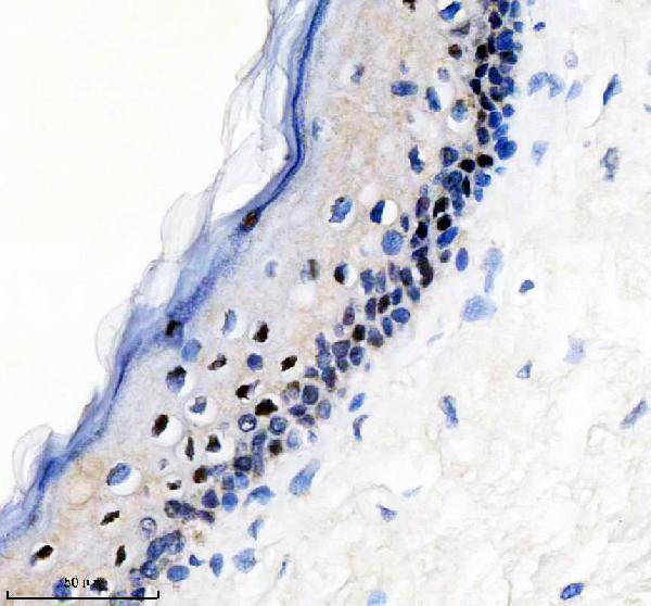 IHC analysis of P-Myc using anti-P-Myc antibody (P00026)