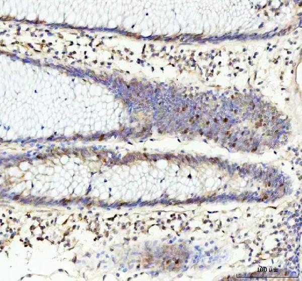  IHC analysis of Retinoblastoma using anti-Retinoblastoma antibody (P00039-1)