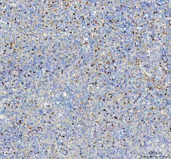  IHC analysis of Retinoblastoma using anti-Retinoblastoma antibody (P00039-1)