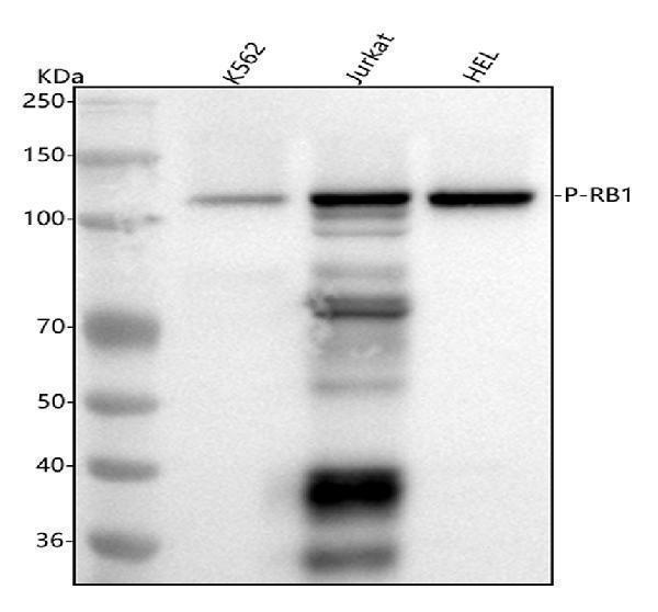  Western blot analysis of Retinoblastoma using anti-Retinoblastoma antibody (P00039-1)