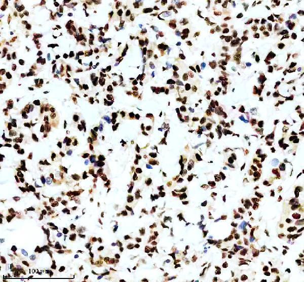 IHC analysis of P-MDM2 using anti-P-MDM2 antibody (P00054-2)