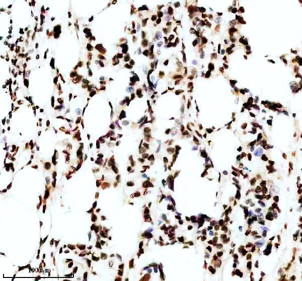 IHC analysis of P-MDM2 using anti-P-MDM2 antibody (P00054-2)
