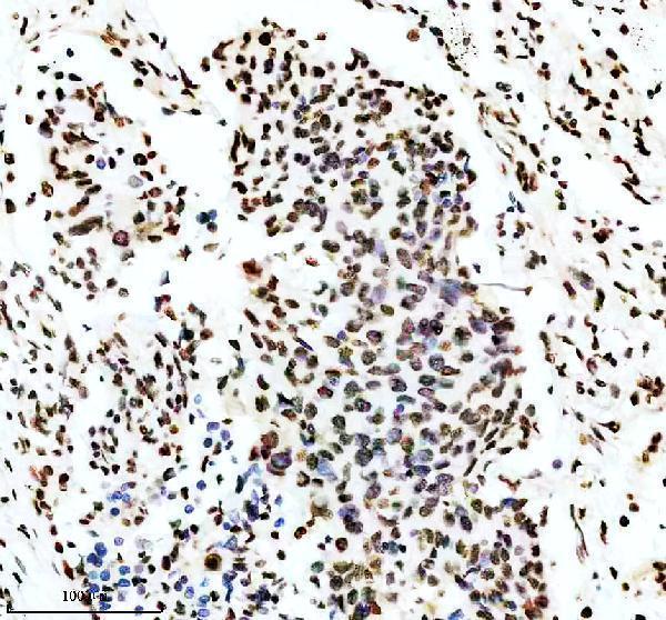 p00054 2 p mdm2 primary antibodies ihc testing 3