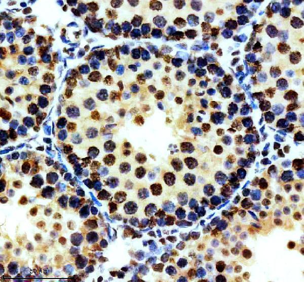 p00054 2 p mdm2 primary antibodies ihc testing 4