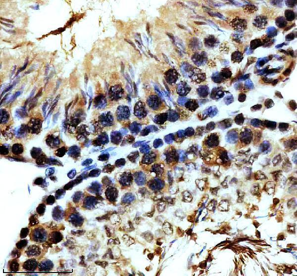 p00054 2 p mdm2 primary antibodies ihc testing 5
