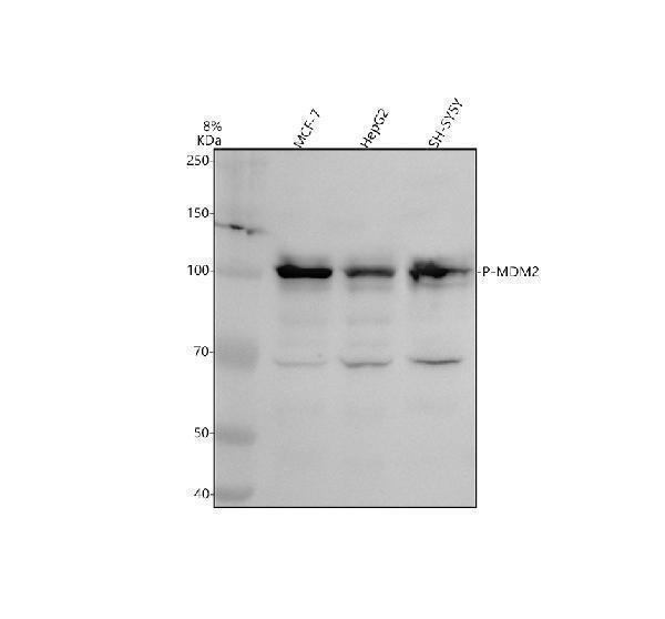 Western blot analysis of P-MDM2 using anti-P-MDM2 antibody (P00054-2)