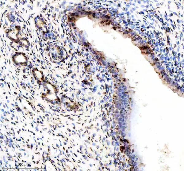 p00057 p esr primary antibodies ihc testing 4