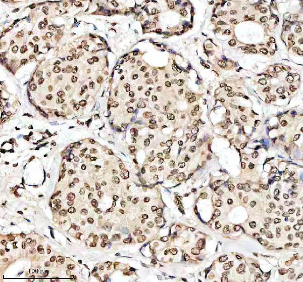p00057 p esr primary antibodies ihc testing 5