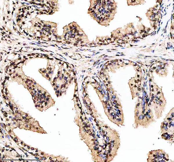 p00057 p esr primary antibodies ihc testing 6