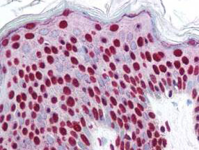 p00059 smad3 primary antibodies ihc testing 1