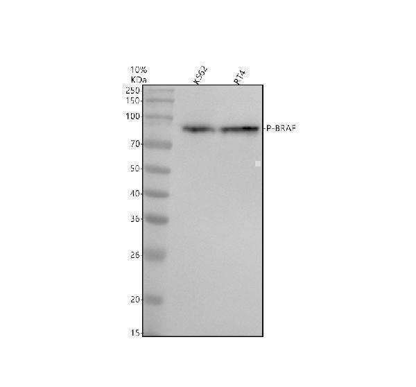 Western blot analysis of P-BRAF using anti-P-BRAF antibody (P00075)