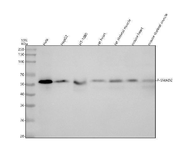  Western blot analysis of Phospho-Smad2 (S250) using anti-Phospho-Smad2 (S250) antibody (P00090-1)