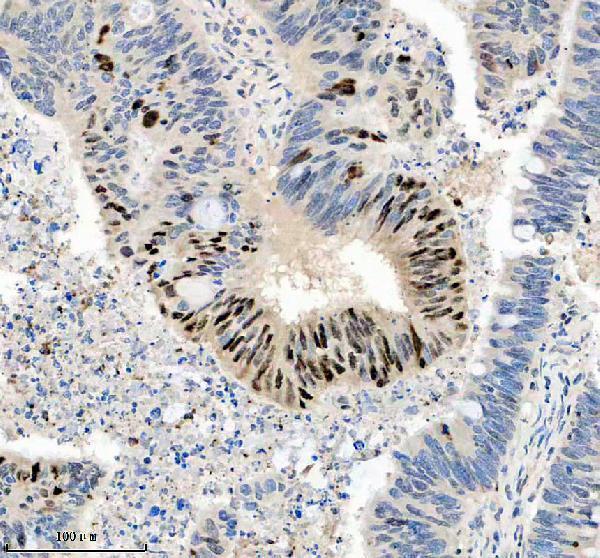 IHC analysis of SMAD2 using anti-SMAD2 antibody (P00090-3)