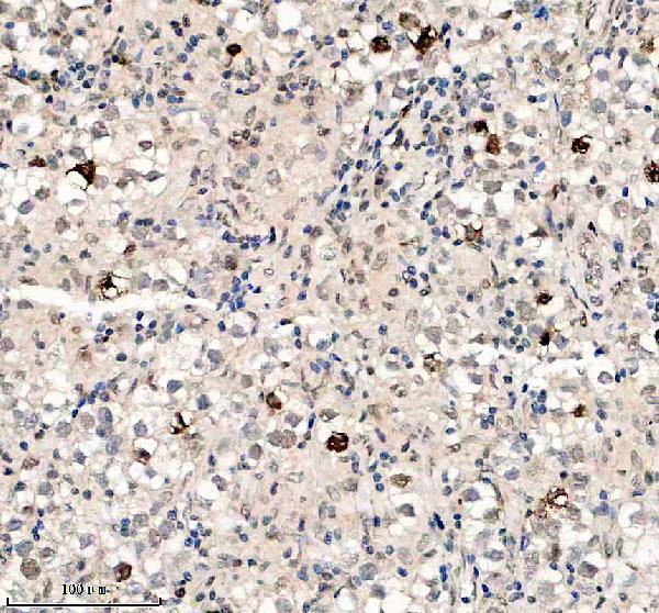IHC analysis of SMAD2 using anti-SMAD2 antibody (P00090-3)